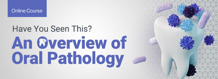 Banner for Have You Seen This? An Overview of Oral Pathology