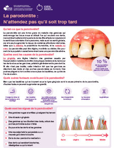 Periodontitis