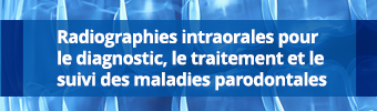 Radiographies intraorales