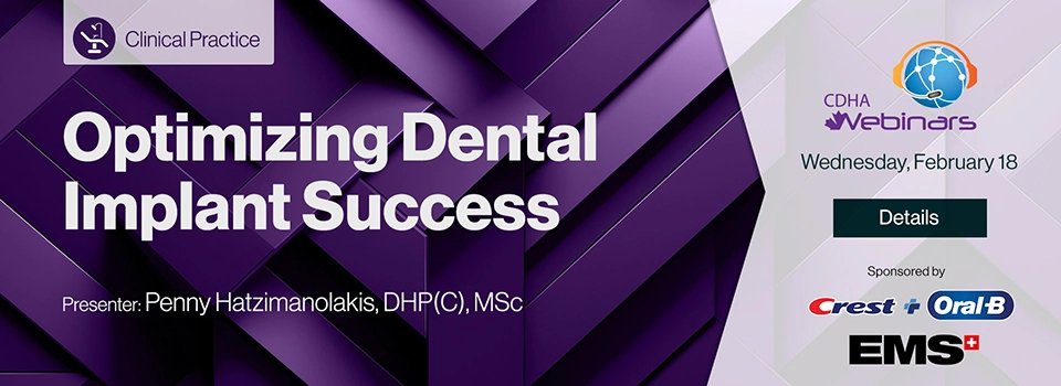 Webinar: Optimizing Dental Implant Success