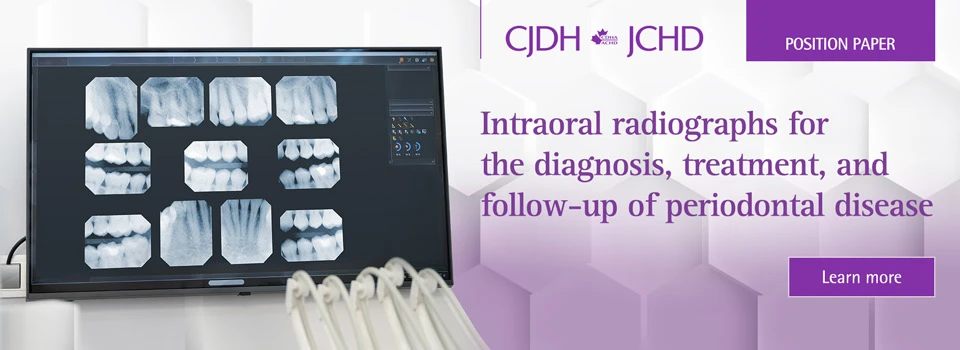 Intraoral radiographs for the diagnosis, treatment, and follow-up of periodontal disease